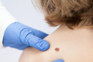 ЗАБОТИТЬСЯ О СВОЁМ ЗДОРОВЬЕ - ЭТО ВАЖНАЯ ЗАДАЧА